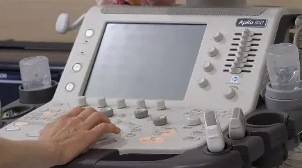 Detalhe do equipamento de ultrassonografia da Clínica Santoro, sem dados de paciente